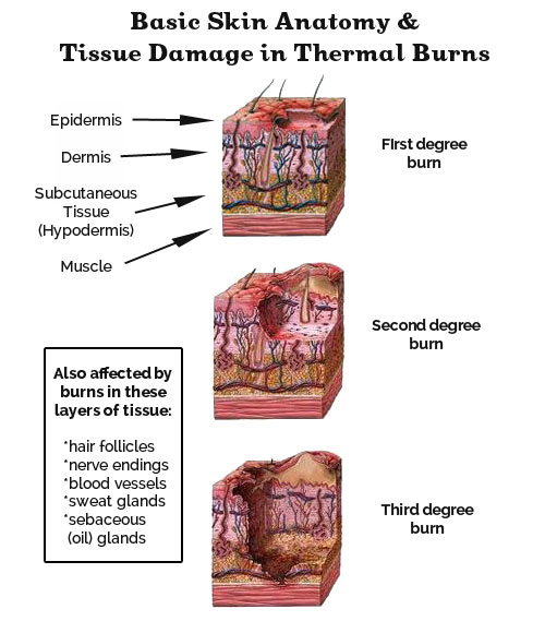 chemical burn on face treatment